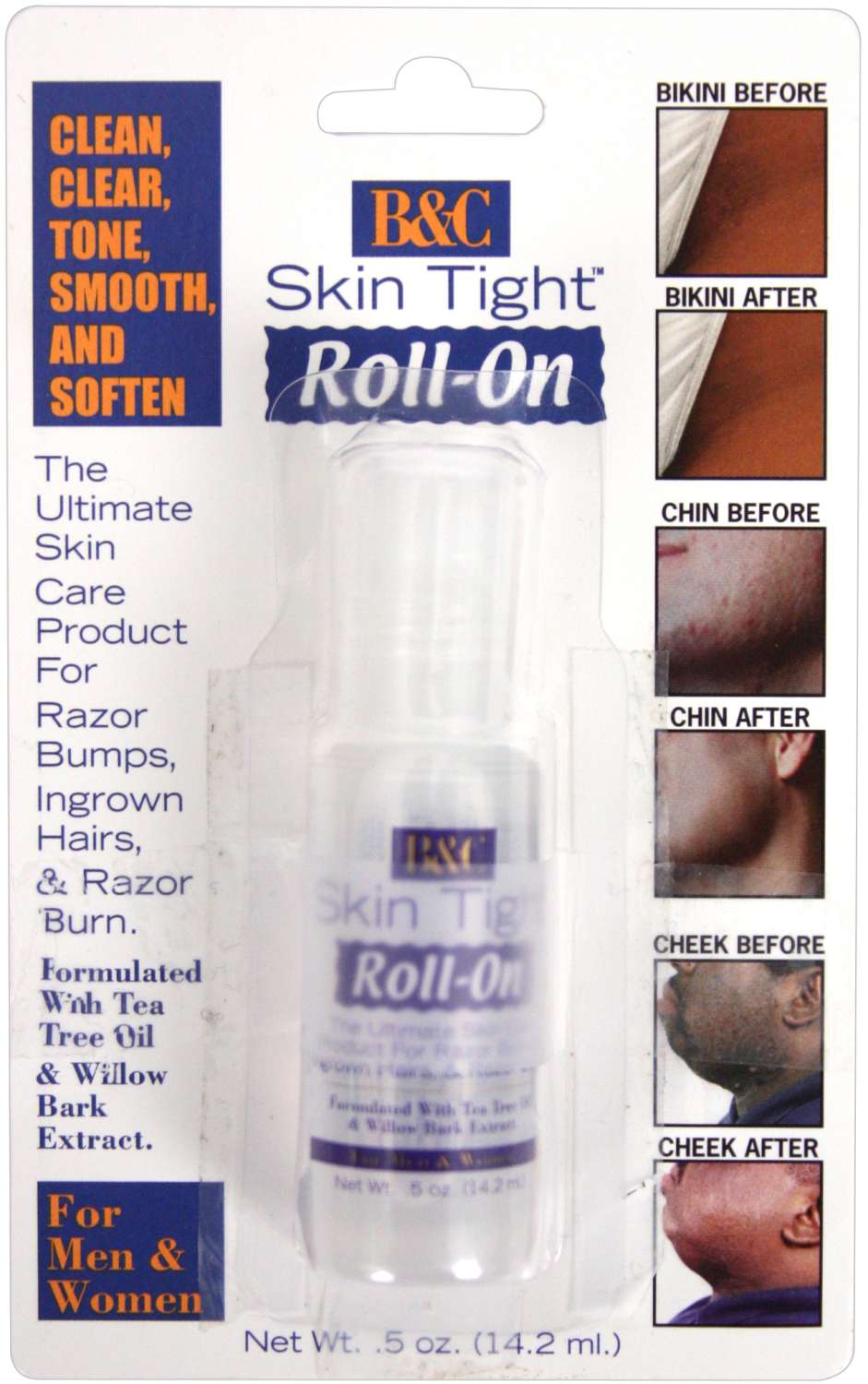 SKINTIGHT RAZOR BUMP ROLL ON [REGULAR] 0.5 OZ