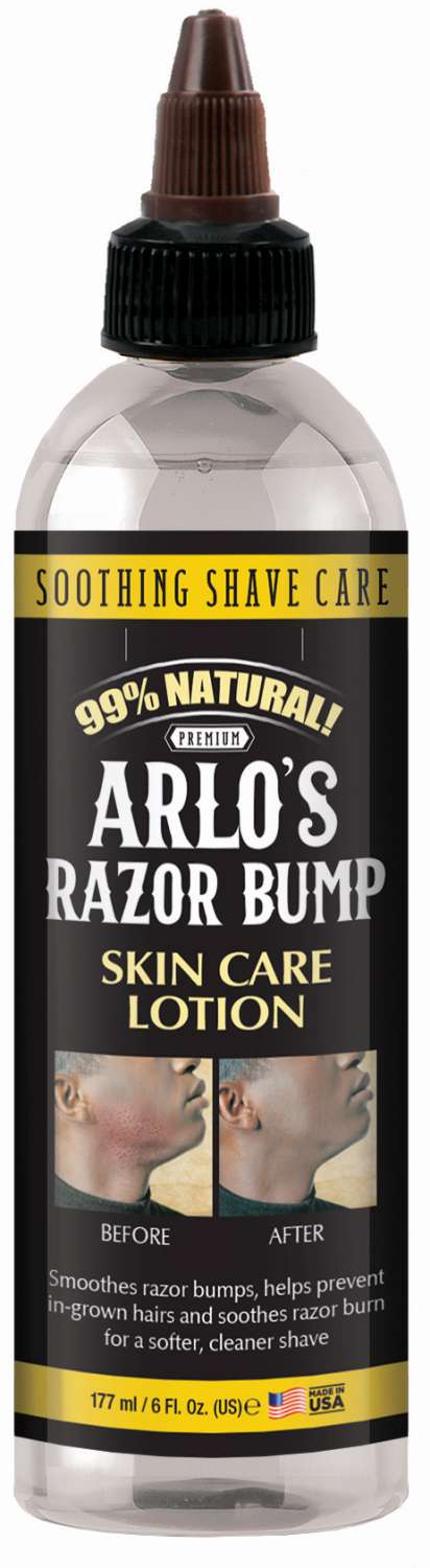 S/F ARLOS RAZOR BUMP SKIN CARE LOTION